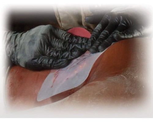 Прозрачный клейкий пластырь (6х6 дюймов) HyFin Chest Seal North American Rescue Прозрачный клейкий пластырь (6х6 дюймов) HyFin Chest Seal North American Rescue