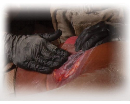 Прозрачный клейкий пластырь (6х6 дюймов) HyFin Chest Seal North American Rescue Прозрачный клейкий пластырь (6х6 дюймов) HyFin Chest Seal North American Rescue