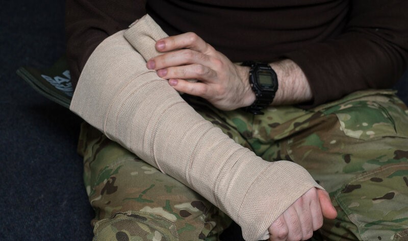 Обзор универсальной шины SAM Splint